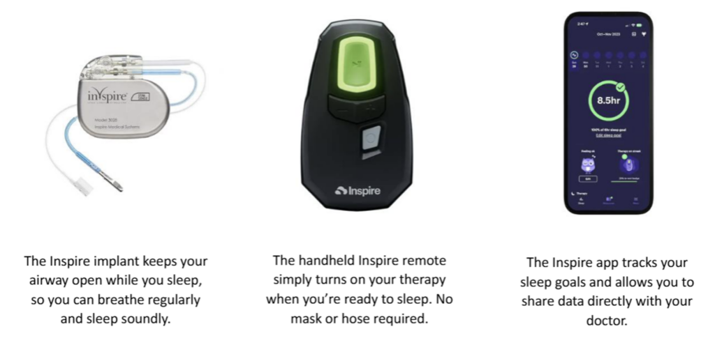 Inspire implant, remote, and app that tracks your sleep goals.